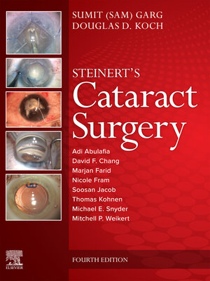 cover image of Cataract Surgery